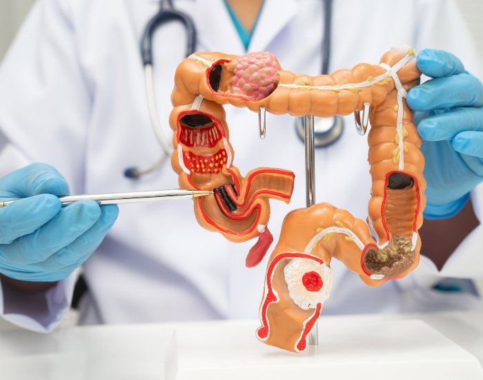 gastroenterologist katy tx best doctor Gastroenterologist in Katy TX | Board-Certified GI Specialist