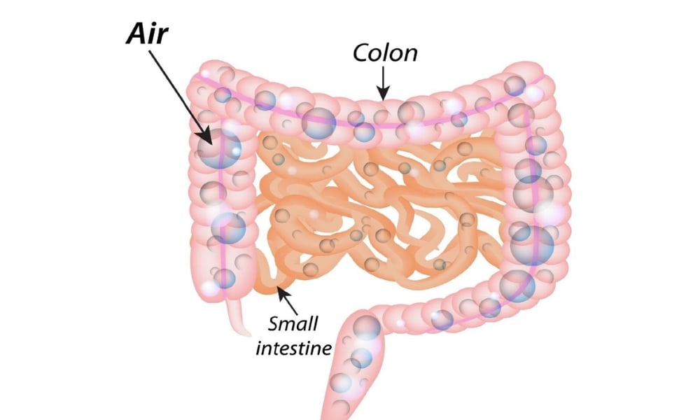 Woman experiencing nighttime bloating and stomach discomfort