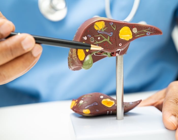 When should I see a liver specialist for elevated enzymes?
