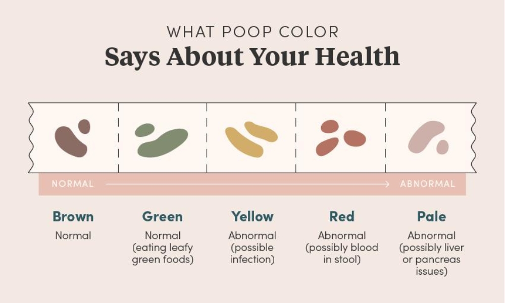 Stool Color Chart: What Different Stool Colors May Mean Physician-reviewed stool color chart showing brown, green, yellow, orange, red, black, and pale stool with possible causes