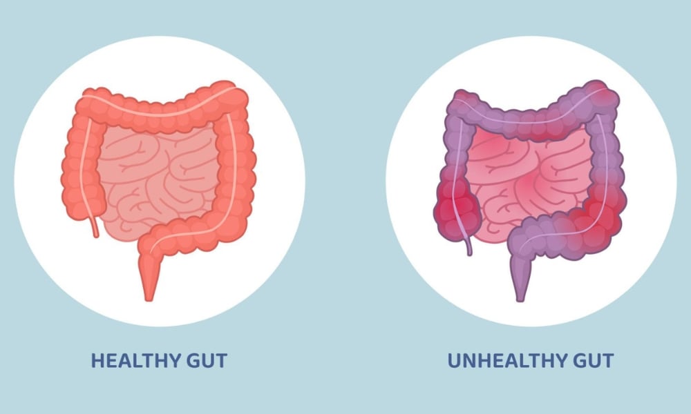 Gastroenterologist consulting patient about chronic bloating
