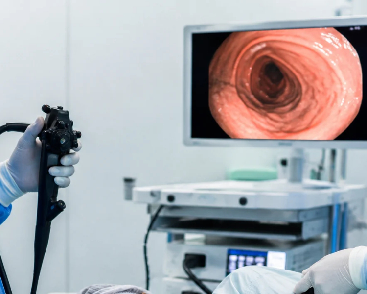 Endoscopy Houston TX GI doctor for colonoscopy Houston