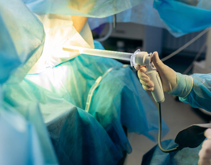 Planning a colonoscopy in Katy or Cypress, Texas
