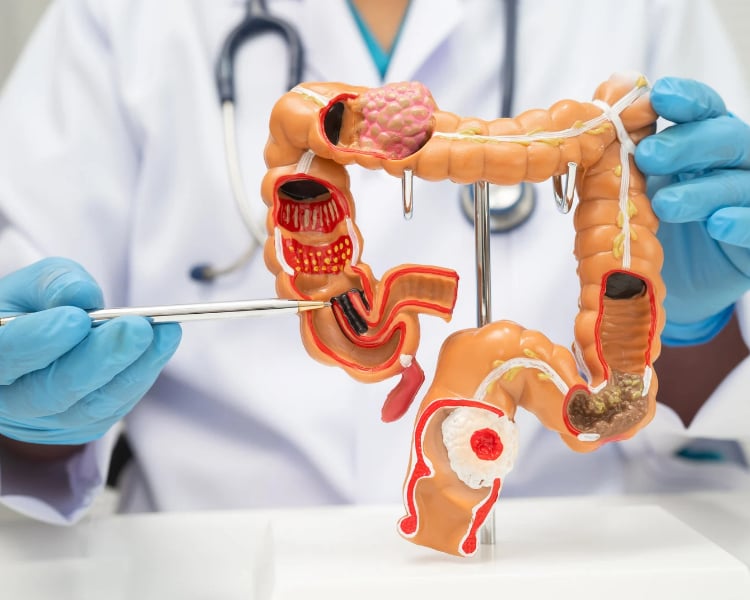 digestive care Cypress digestive disease specialist Cypress,
