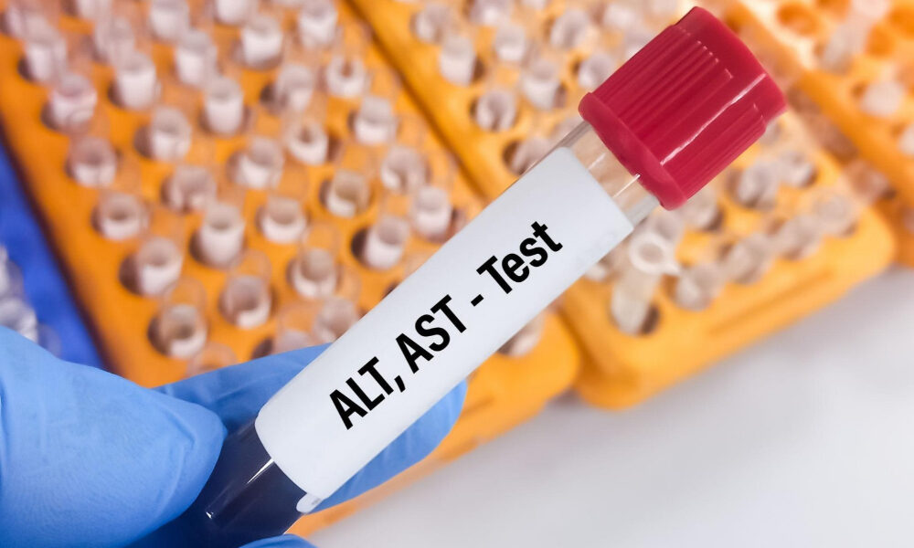 elevated liver enzymes and liver disease