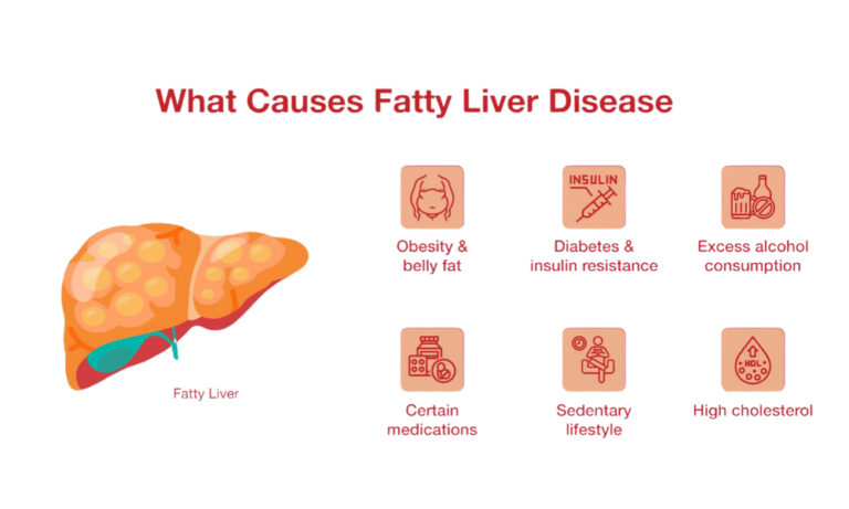 can ultrasound detect fatty liver