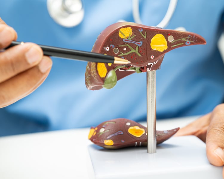 fatty liver disease specialist specialist for food getting stuck when swallowing