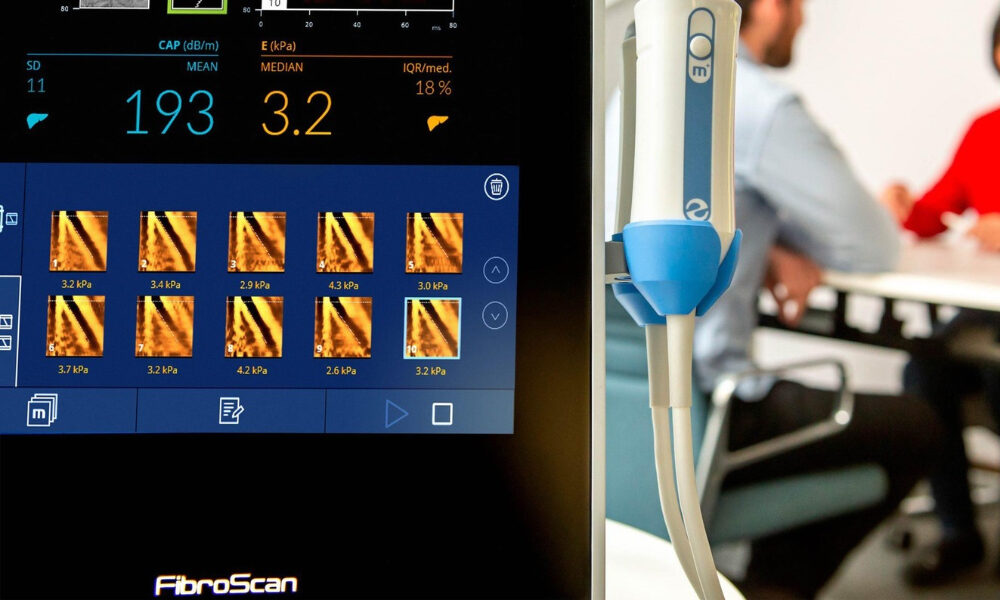 what is FibroScan FibroScan liver test